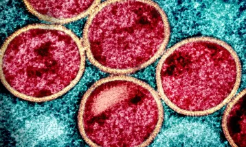 Saúde confirma primeiro caso de nova cepa de mpox no Brasil