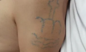 HUOP busca identificar paciente internado sem documentos