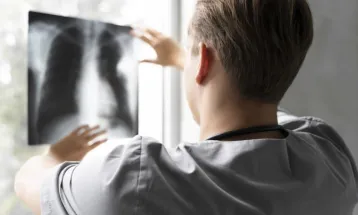 Médico consegue adiar incorporação ao Exército para concluir curso de especialização em Radiologia