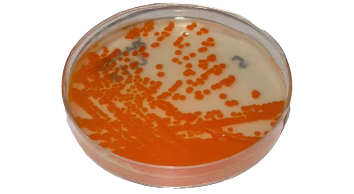 Bactéria comum em gestantes está circulando mais e com maior resistência aos antibióticos