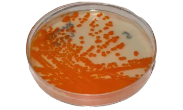 Bactéria comum em gestantes está circulando mais e com maior resistência aos antibióticos