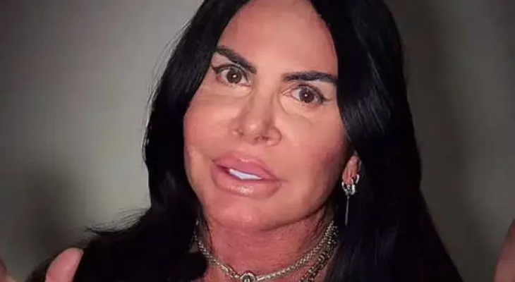 Gretchen se manifesta sobre críticas após novo procedimento estético