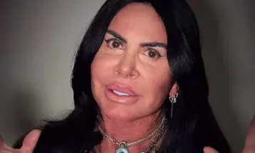 Gretchen se manifesta sobre críticas após novo procedimento estético