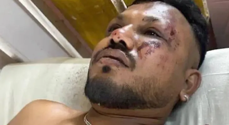 Único sobrevivente de acidente aéreo relata cena de terror ao sair de aeronave: