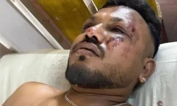 Único sobrevivente de acidente aéreo relata cena de terror ao sair de aeronave: "Corpos por todos os lados"