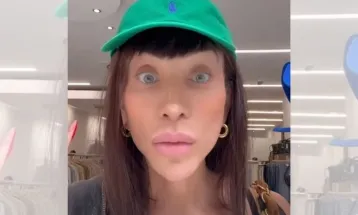 Médico alerta para risco de mudar a cor dos olhos, como Maya Massafera