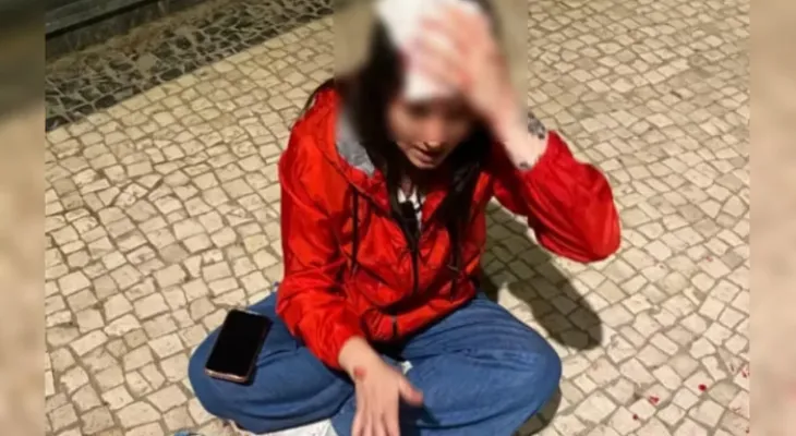 Brasileira leva pedrada na cabeça em Portugal: “Fala baixo, vaca”