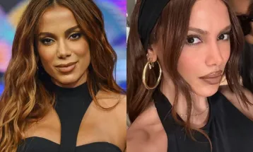 Anitta revela já ter feito mais de 50 procedimentos estéticos ao longo da vida