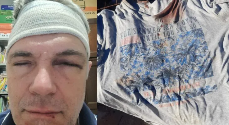 Oficial de Justiça é agredido com lajota pelas costas durante cumprimento de mandado