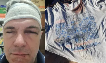 Oficial de Justiça é agredido com lajota pelas costas durante cumprimento de mandado