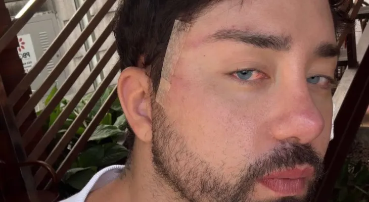 Rico Melquiades deixa fãs em choque ao surgir com olhos azuis e é comparado a personagem de “O Senhor dos Anéis”