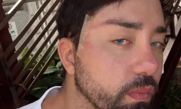 Rico Melquiades deixa fãs em choque ao surgir com olhos azuis e é comparado a personagem de “O Senhor dos Anéis”