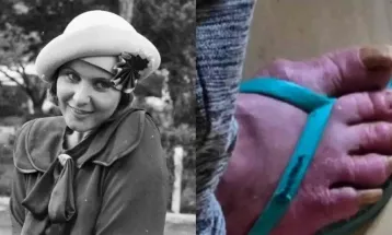 Atriz de grandes novelas da Globo é encontrada em situação precária no RS