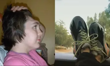 Pés no painel? Irlandesa que perdeu a testa alerta sobre risco quase fatal