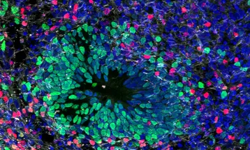 Intoxicação por chumbo pode ter impedido neandertais e outras espécies humanas de se comunicarem