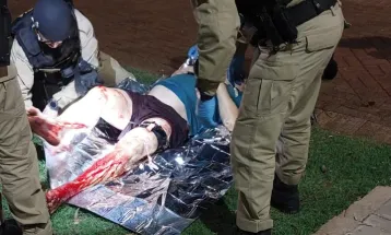 Ataque de cães deixa duas pessoas feridas no bairro Tropical