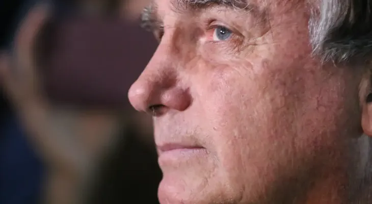 Após pedido de cirurgia, Moraes manda PF fazer perícia em Bolsonaro