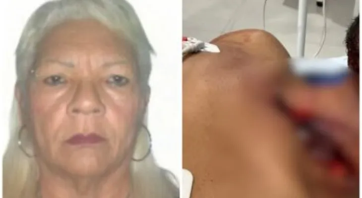 Discussão por sexo termina em ataque brutal com navalha em supermercado