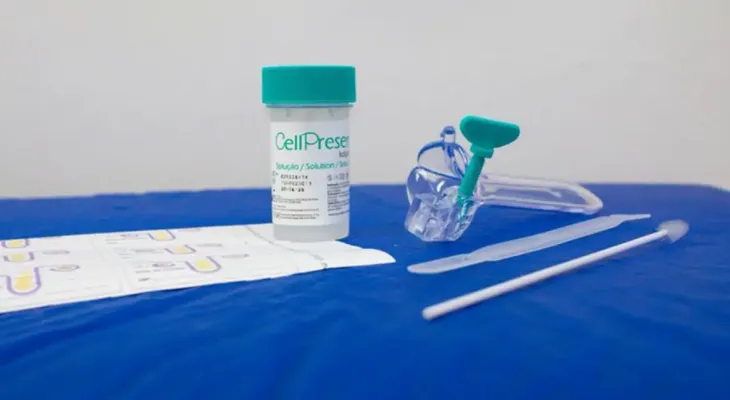 Guia orienta sobre mudança de rastreamento do câncer de colo do útero