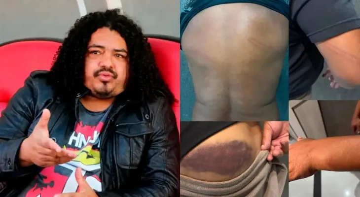 Ex-jogador Perdigão denuncia agressão de policial militar após jogo do Paranaense em Curitiba