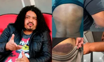 Ex-jogador Perdigão denuncia agressão de policial militar após jogo do Paranaense em Curitiba