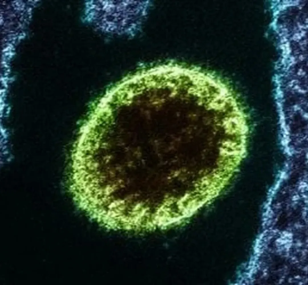 Vírus Nipah volta a preocupar após novos casos registrados na Índia