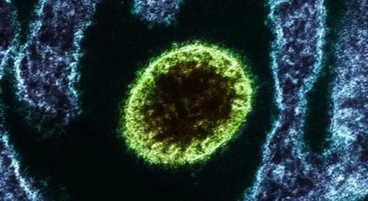 Uganda confirma mais três casos de ebola; total sobe para cinco