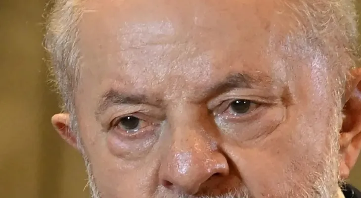 Lula passa por cirurgia de catarata e recebe alta no mesmo dia