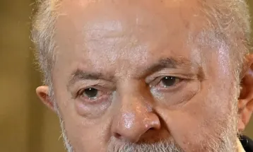 Lula passa por cirurgia de catarata e recebe alta no mesmo dia