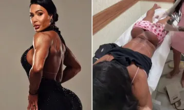 Gracyanne Barbosa remove tatuagem feita em homenagem ao cantor Belo