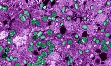 Doença Mpox: Brasil já registra 149 casos em 2026; veja estados com mais registros