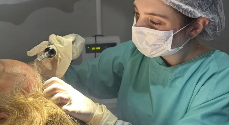 Alopecia: saiba como identificar os tipos de calvície e como tratar pelo SUS no Paraná