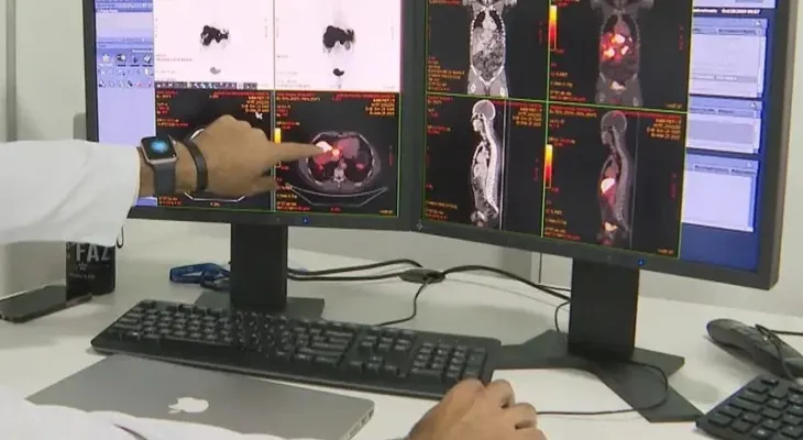 SUS adota novo exame mais preciso para detectar câncer colorretal