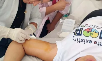 Procura por implante contraceptivo gratuito no SUS cresce 380% no Paraná