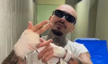 Streamer perde dedo durante live ao tentar encontrar falha na segurança do Rock in Rio